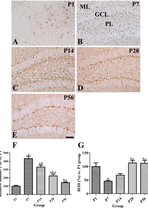 Figure 2. Immunohistochemical staining for glucose transporter 3 (GLUT3) in the mouse dentate gyrus at P1 (A), P7 (B), P14 (C), P28 (D), and P56 (E)