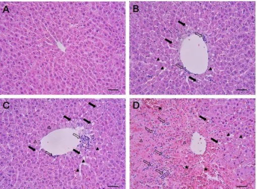 Figure 1. Effects of 1,3-DCP on hepatic histopathology. Representative photographs of liver sections of (A) control showing normal appearance and rats treated with 1,3-DCP at doses of (B) 27.5, (C) 55, and (D) 110 mg/kg showing various histopathological al