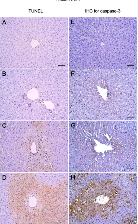 Figure 2. Effects of 1,3-DCP on hepatic cellular apoptosis. Representative photographs of TUNEL assay (A-D) and immuno- immuno-histochemical analysis of caspase-3 (E-H) performed on liver sections