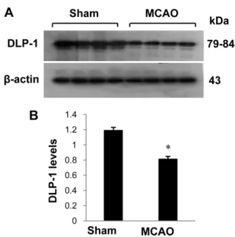 Figure 2. Dynamin-like protein 1 (DLP-1) protein spots identified by MALDI-TOF in the sham-operated and middle cerebral artery-occluded (MCAO) animals
