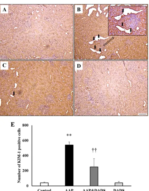 Figure 3. Representative photographs of immunohistochemical analysis of KIM-1 in kidney sections of (A) controls and rats treated with (B) AAP, (C) AAP&amp;DADS, and (D) DADS