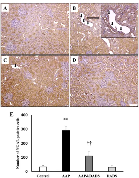 Figure 4. Representative photographs of immunohistochemical analysis of NGAL in kidney sections of (A) controls and rats treated with (B) AAP, (C) AAP&amp;DADS, and (D) DADS
