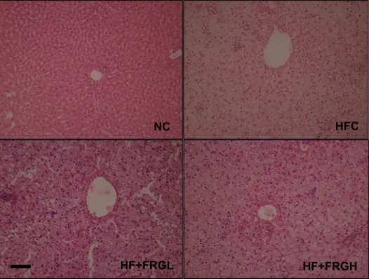 Figure 3. Histopathological examination of the rat liver tissues in hyperlipidemic rats treated with fermented red ginseng (FRG).