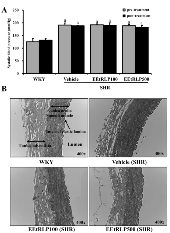 Figure 2. EEtRLP effect on systolic blood pressure and the histological structure of thoracic aorta