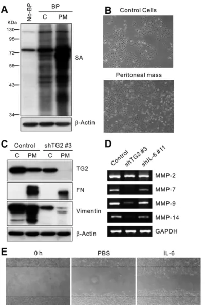 Figure 4. TG2-knocked-down or IL-6-knocked-down ovarian cancer cells revealed reduced epithelial-to-mesenchymal transition and  in vitro migration
