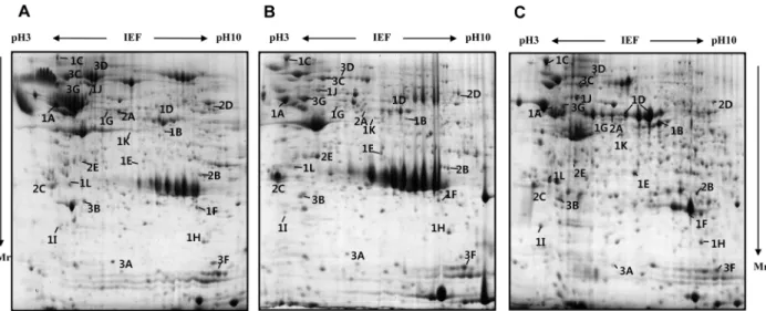 Figure 1. Representative Coomassie blue stained 2-DE gels of pig pancreas based on developmental stages