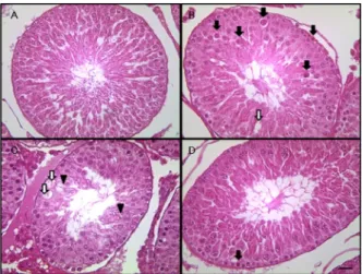 Figure 2. Representative photographs of testis sections treated with CP and/or DADS. Testis from vehicle (A) treated rats showing normal appearance