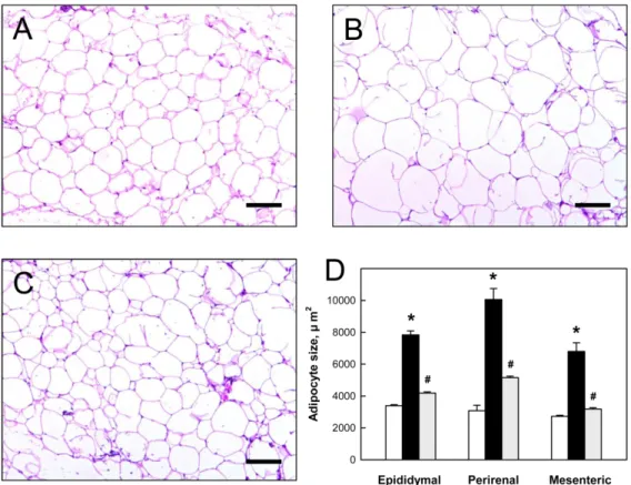 Figure 4. A-C: Representative findings of perirenal adipose tissue of mice fed normal diet (A), high-fat  diet  (HFD) alone (B) or containing 3% Rapha diet ®  preparation (C) for 8 weeks