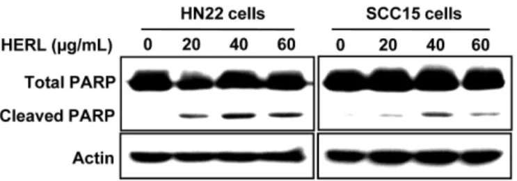 Figure 5. The effect of hexane extract of Rheum undulatum L. (HERL) on the regulation of Sp1 and survivin protein expression.