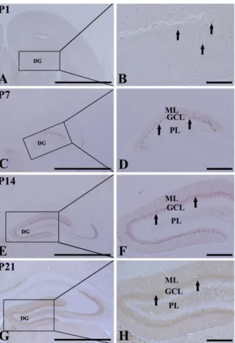 Figure 3. Immunohistochemical staining for calbindin (CB) in the DG at P1 (A and B), P7 (C and D), P14 (E and F), and P21 (G and H)