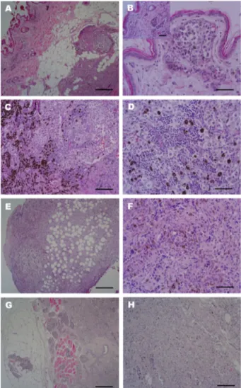 Figure 1. Histopathological findings of the most extensively invaded lesions, skin and mammary glands