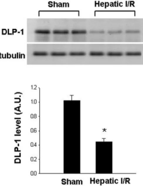 Figure 4.  Western blot analysis of dynamin-1-like protein (DLP- (DLP-1) in liver tissue of sham-operated and  ischemia/reperfusion-operated animals
