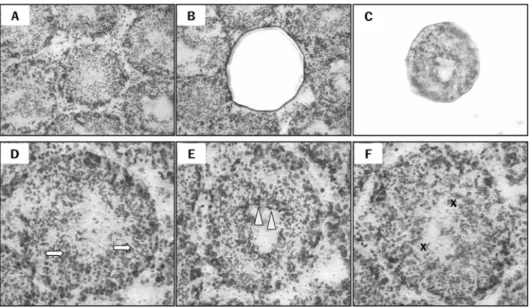 Figure 2.  Stage-specific expression of cytoplasmic Cu,Zn- Cu,Zn-superoxide dismutase (SOD1) mRNA during spermatogenesis.