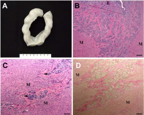Figure 1.  Gross and microscopic findings of adenomyosis. The uteri of the dogs were markedly enlarged (A)