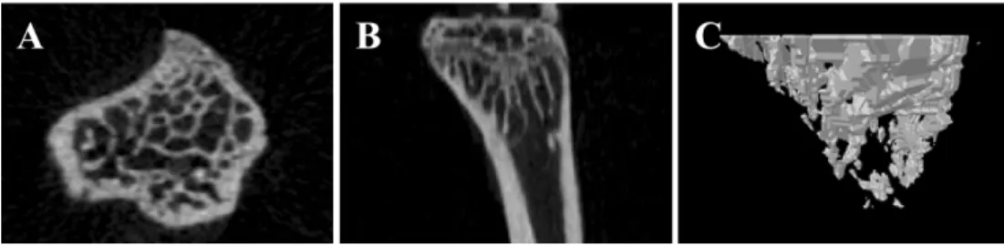 Figure 1. Micro-CT images of the tibia of 14-week-old C3H/HeN mice. Cross sectional view (A), vertical view (B) and reconstructed three-dimensional image (C) are represented.
