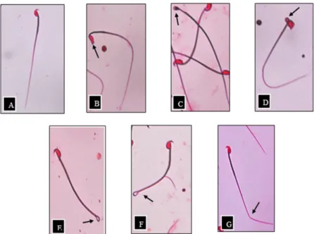 Table 7. Effects of repeated doses of A. malacensis leaves extract on sperm parameters of mice given 21 days’ treatment