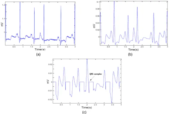 Fig. 2 QRS cancellation (a) original ECG (b) Filtered ECG (c) QRS Cancellation