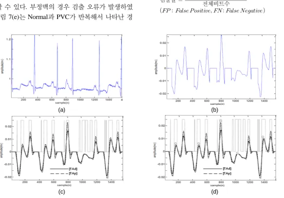 Fig. 5 moving average of 4 PAC pattern (a) Original ECG (b) QRS cancellation (c) Target Block of two moving  average (d) T wave detection result