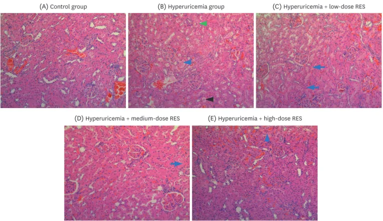 Fig. 5. RES ameliorates renal morphological changes and reduces the infiltration of inflammatory cells in the kidney