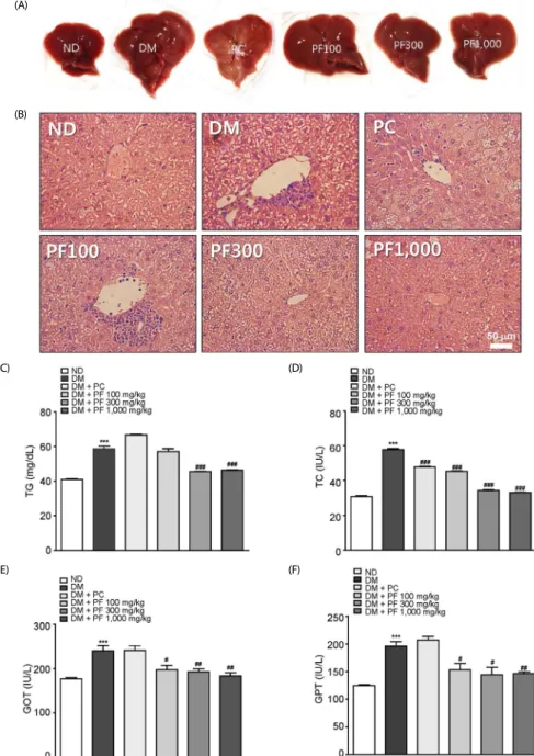 Fig. 5. Comparison of liver damage after Perilla frutescens (L.) Britton var. (PF) sprout extract treatment in db/db mice