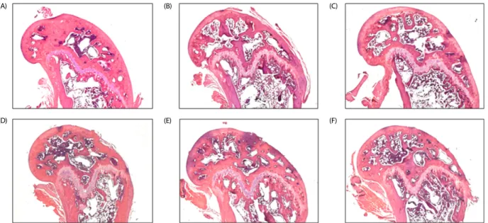 Table 3. Serum levels of calcium and phosphorous in ovariectomized mice treated with isoflavone-enriched whole soy milk powder for 8 weeks