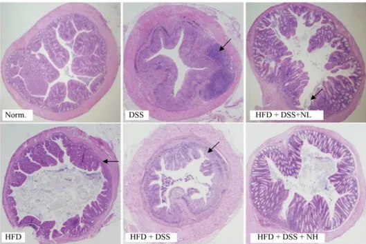 Fig. 3.  Histological  observations  of  colon  tissue  damage  in  mice  treated  with  NRM,  HFD  (45%),  and/or  DSS  The  arrow  (→) indicates specific points of inflammation.