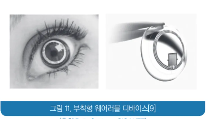 그림 11. 부착형 웨어러블 디바이스[9]