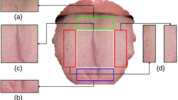 Fig. 8  A  result  of  tongue  region  detection