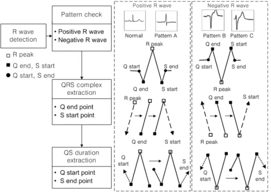 Fig. 3 Phase transition tracking method2.3. 특징점 추출 QRS간격은 심장 주기를 예측할 수 있기 때문에 부정맥 분류를 위한 필수적인 파라미터로 사용되어왔다
