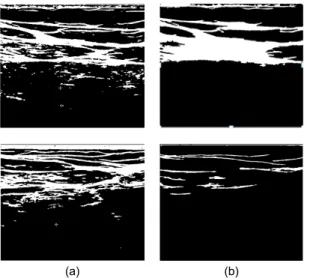 Fig. 2  The Effect of Region Labelling and Noise Removal  (a) Max-Min Binarization (b) Noise Removal