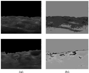 Fig. 5 The Snapshot of Appendix Extraction