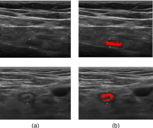 Fig. 7 The Comparison of  A ppendix Extraction Results  (a) Extraction via Previous Approach (b) Extraction via  Proposed Method