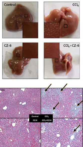 Fig. 6. Liver histology in mice after CCl 4  and CZ-6 treatments. The method for  the  administration  of  CZ-6  and  induction  of  liver  injury  are  described  in  ‘Materials  and  Methods’  section