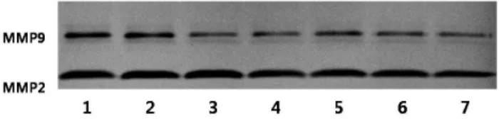 Fig. 5. Effects of Eriobotrya japonica Lindley on the activities of MMP2 and  MMP9 of MDA-MB231 cells