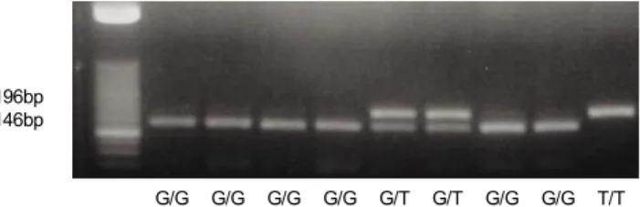 Fig. 1. PCR-based Bsm-RFLP analysis of the intron-2 polymorphism of the  adiponectin gene