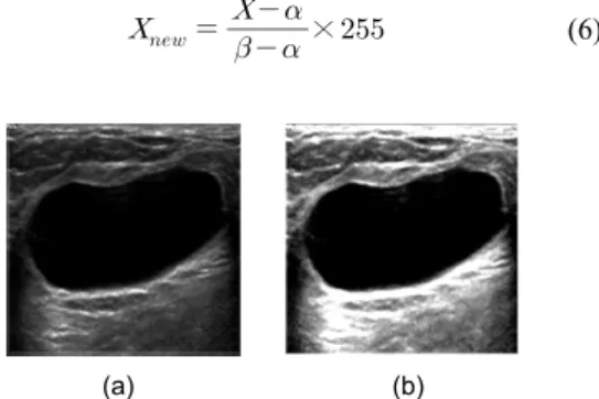 Fig. 3 Result of enhanced fuzzy binarization (a) Fuzzy  Stretching (b) Enhanced fuzzy binarization