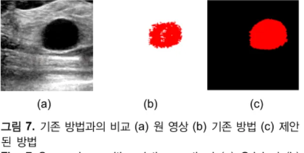 Fig. 7 Comparison with existing method (a) Original (b)  Existing (c) Proposed Ⅴ. 결론 및 향후 연구 방향 현대 시대의 사람들은 일상생활에서 흔히 발생하는  결절종을 큰 질환이 아니라고 인식하는 경우가 많아 방 치해 두는 경우가 있다