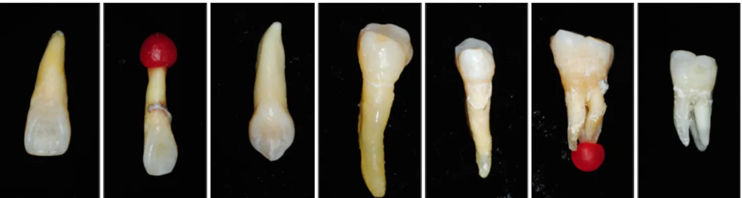 Fig.  1.  Seven  tooth  phantoms:  all  contain  cavities  inside. 선 영상에서 주어진 정보는 다른 치아 우식증 검출 시스템 들과 마찬가지로 노이즈와 영상외곡을 포함한 다양한 입력 정보로 얽혀져 있기 때문에(Convoluted  image)  올바른 진단을 위해 필요한 치아 정보를 얻기 위해서는 결국 영상 분석이라는 과정이 요구된다