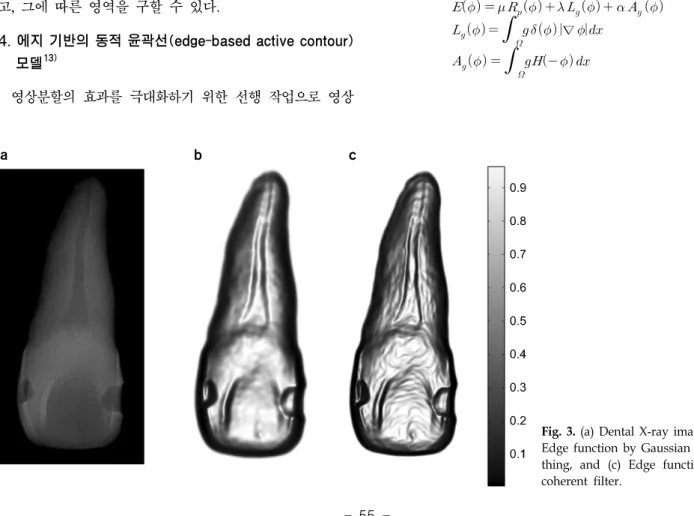 Fig.  3.  (a)  Dental  X-ray  image,  (b)  Edge  function  by  Gaussian   smoo-thing,  and  (c)  Edge  function  by  coherent  filter.위한 에너지 함수는 DRLSE를 사용하였다