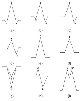 Fig. 4 QRS pattern (a)   (b)   (c)    (d)     (e)   (f)   (g)  or  (h)      (i)   ′ 2.4