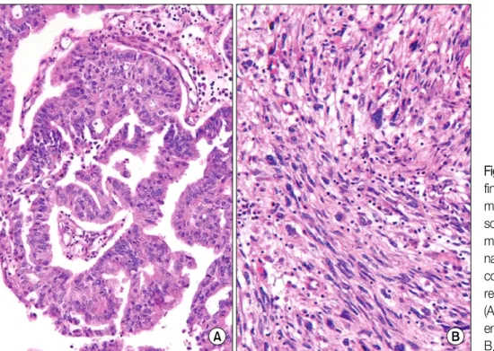 Figure 2. Initial chest computed tomography. (A) The axial image at the level of basal trunk of the left lower lobe bronchus reveals central lung cancer in the left lower lobe and massive  subcarinal lymph node enlargement