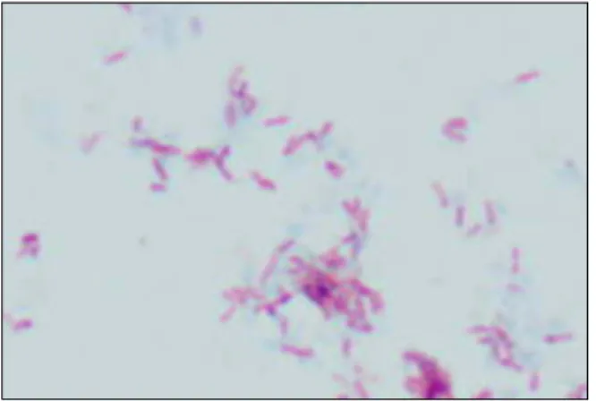 Figure  4.  AFB  stains  (Ziehl-Neelsen  stains)  of  induced  sputum specimens (×1,000)