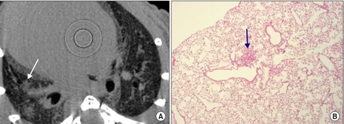 Figure  2.  Micro  CT  finding  (A)  and  pathologic  finding  (B)  of  bleomycin-treated  mice  that  is  classified  as  small  nodule according to the pattern of micro CT finding