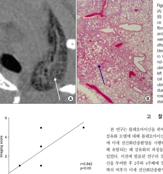 Figure  5.  Micro  CT  finding  (A)  and  pathologic  finding  (B) of bleomycin-treated  mi-ce  that  have  severe  lung  fibrosis