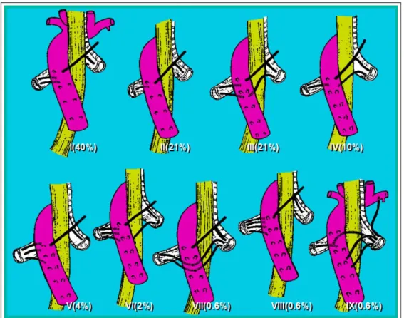 Figure 1.  Anatomic variations of bronchial arteries