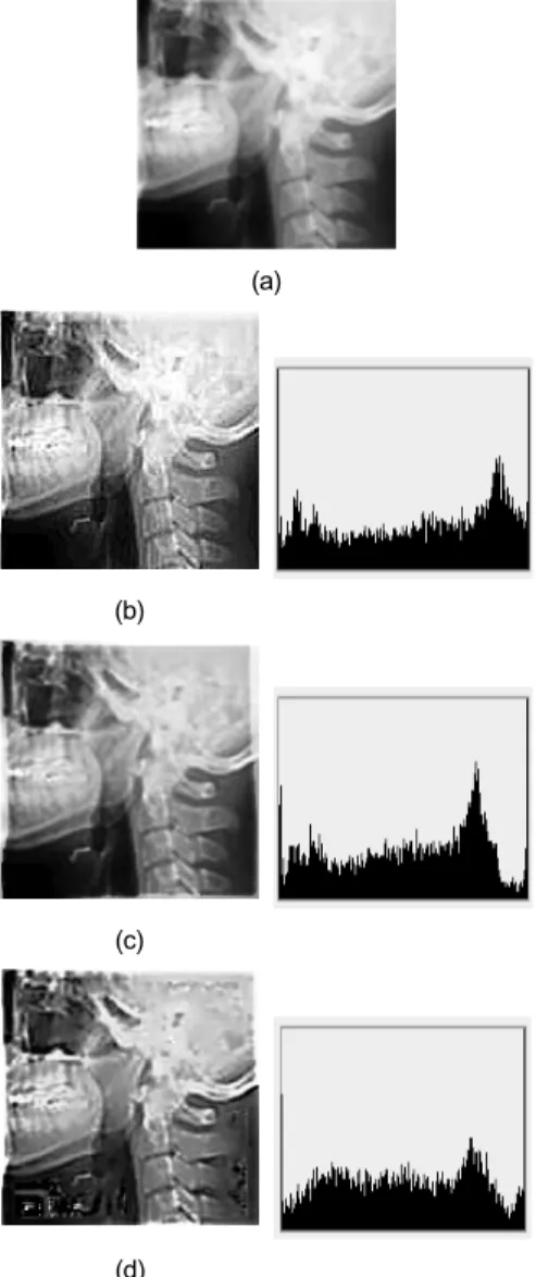 Fig. 4 The Simulation result of Case image (a) Original  image (b) UNSHARP image (c) HOMO image (d) PFA  image 고주파통과 필터는 퓨리에 변환의 낮은 주파수를 감 쇠시키고 , 반대로 높은 주파수를 유지함으로써 에지부 분들을 선명하게 만든다 [8]