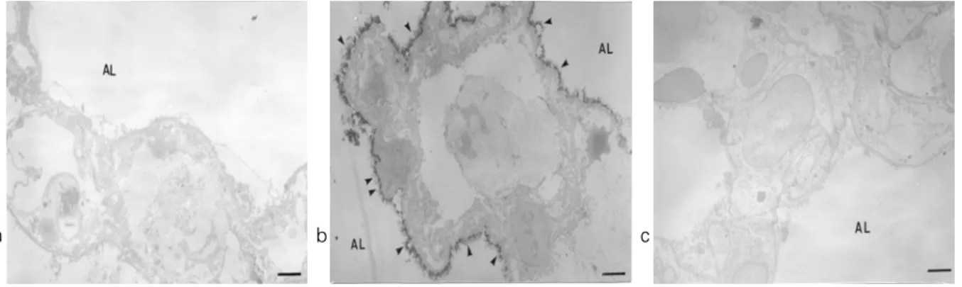 Figure 11. Detection of hydrogen peroxide with CeCl 3  cytochemical electron microscopy