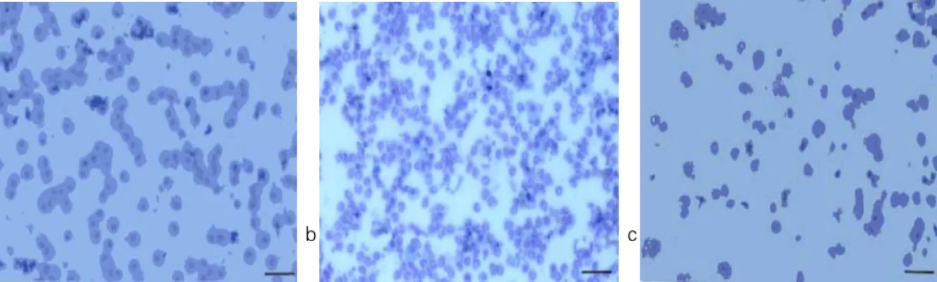 Figure 10. Ultrastructural  changes  of  the  lung  in  endotoxin  and  endotoxin  with  diltiazem  treated  rats