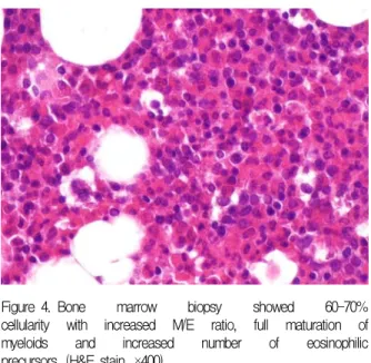 Figure 4. Bone  marrow  biopsy  showed  60-70% 