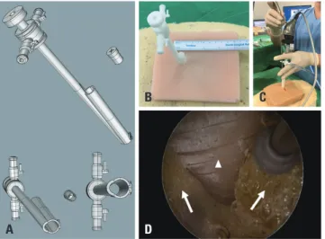 Fig. 3. New endoscope-assisted spine surgery system with an additional  working portal